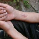 UN chief calls for people-centered approach to combat drug stigma