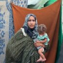 Gaza: 8,000 children diagnosed with malnutrition amid ongoing shelling