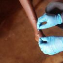 Mpox: What you need to know about the latest public health emergency
