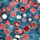 Mpox alert: UNICEF issues $58.8 million appeal to halt outbreak in Africa