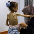 In Gaza, mounting evidence of famine and widespread starvation
