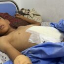 Gaza: Hospitals ‘at near-total collapse’, staff overwhelmed by the injured