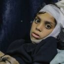 Drone victims, terror and death: 30 minutes inside a Gaza hospital