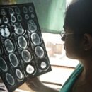 WHO calls for greater investment in brain health and care services