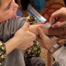 Global measles cases surge as 30 million children miss vaccines, UN health agency warns