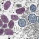 New recombinant mpox strain detected in UK and India, WHO urges continued monitoring