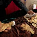 ‘We are dying’: Gaza’s cancer patients plead for a way out