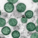Hantavirus outbreak: Another passenger contracts disease